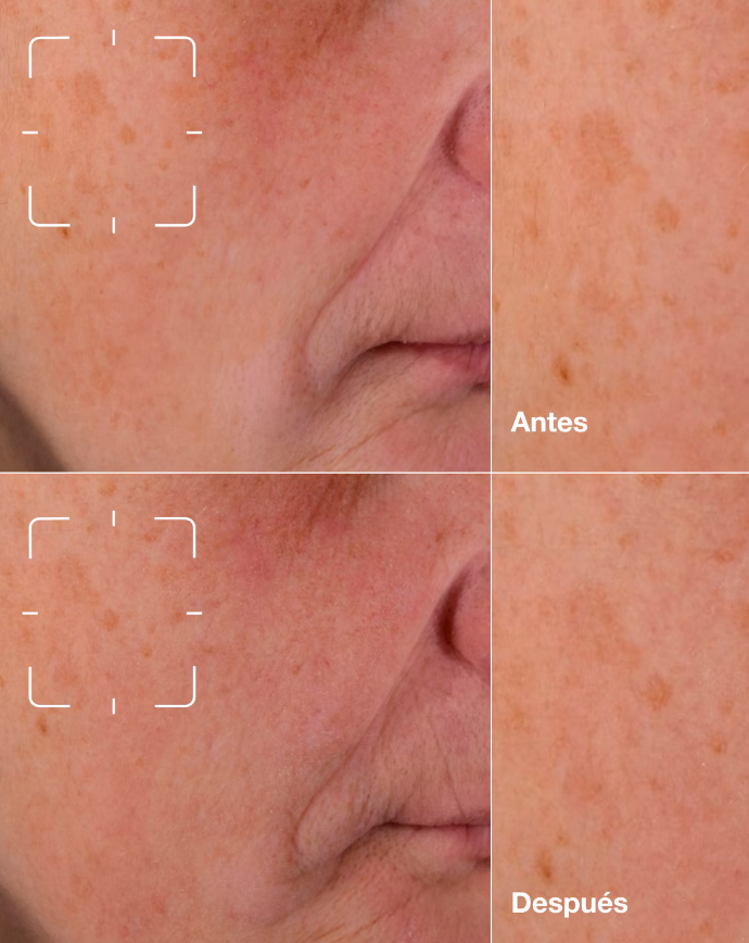 Sérum Facial Unificador Even Better Dark Spot De Clinique Para Todo Tipo De Piel